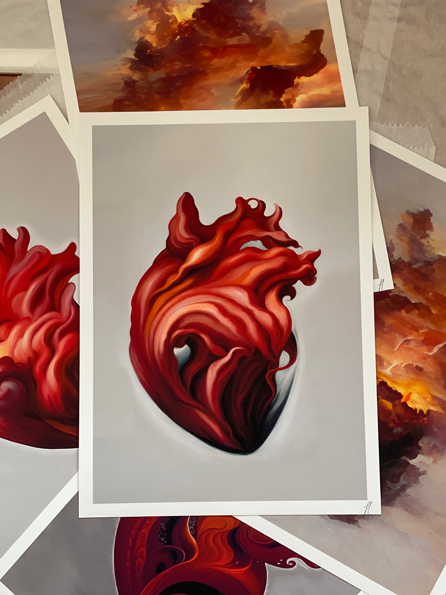 Cardiac Flow