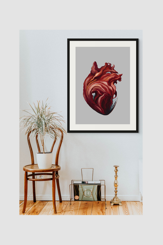 Cardiac Surge